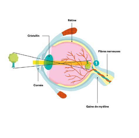 Comparaison visuelle entre une transmission monoplateau et une transmission biplateau