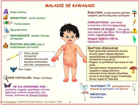 Illustration schématique des symptômes typiques de la maladie de Kawasaki (fièvre, éruption cutanée, conjonctivite, langue framboisée, œdème des mains et des pieds)